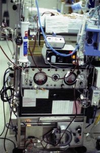 Our first three ECMO pumps were modified artificial kidney machines as shown here.